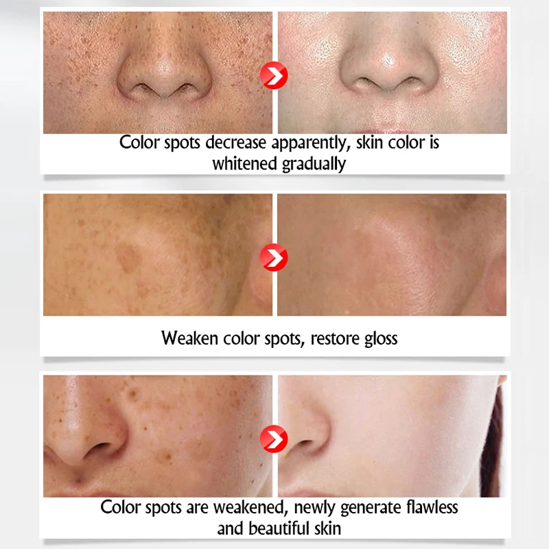 Collagen Face Cream Freckles Whitening Day Cream hyaluronic acid Anti-Aging Anti-Wrinkle Remove Spots Firming Brighten BEACUIR Collagen Face Cream Freckles Whitening Day Cream hyaluronic acid Anti-Aging Anti-Wrinkle Remove Spots Firming Brighten BEACUIR