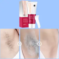 2019 тела крем для удаления волос для мужчин и женщин ручной нога выпадения волос крем для депиляции удаление подмышки Уход за волосами крем