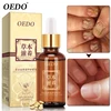 OEDO Healthy Nail Care Herbal Fungus Nail Repair Essential Oil Hand and Foot Bright White Toe Nail Remove Fungus Infected Nail ► Photo 3/6