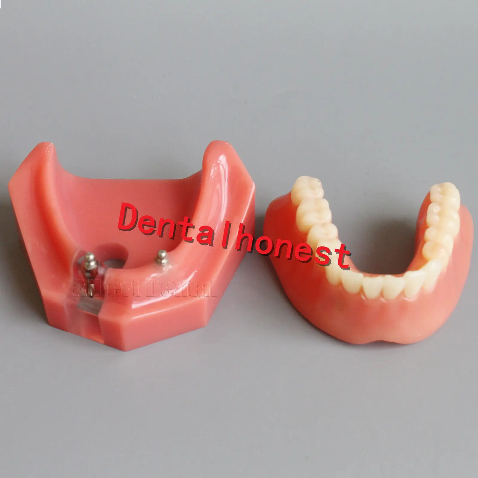 Стоматологическая Утонченная имплантата Overdenture 6007 модель зубов 2 имплантаты зубная модель
