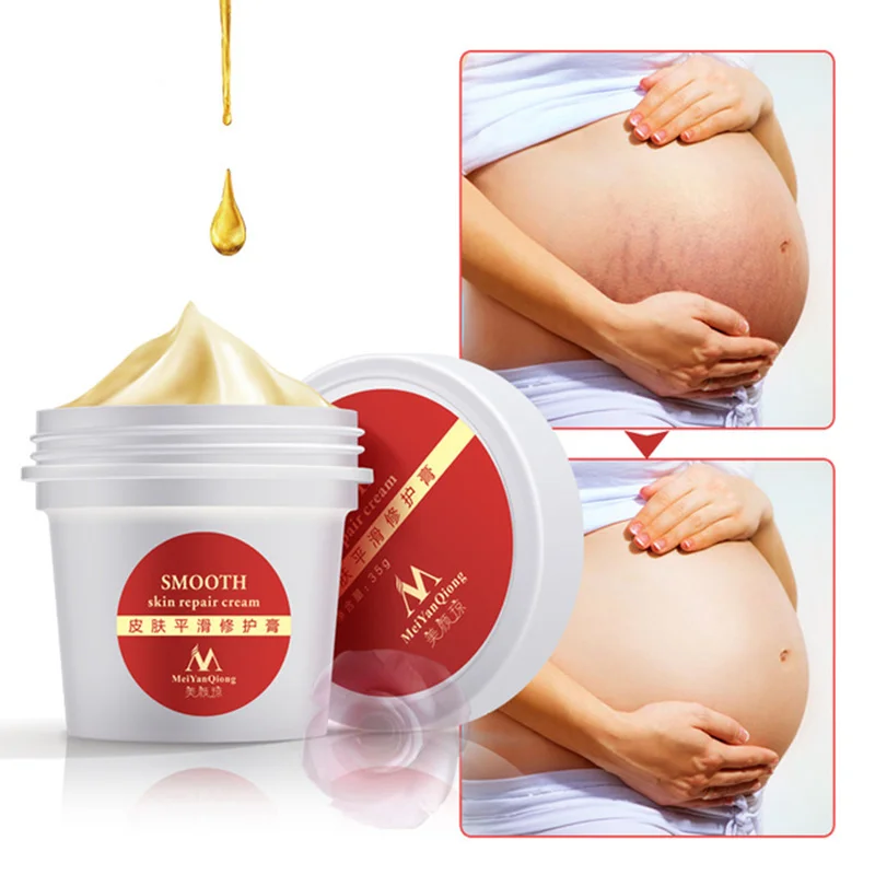 Newest 1Pc Precious Skin Body Cream Stretch Marks Remover And Scar