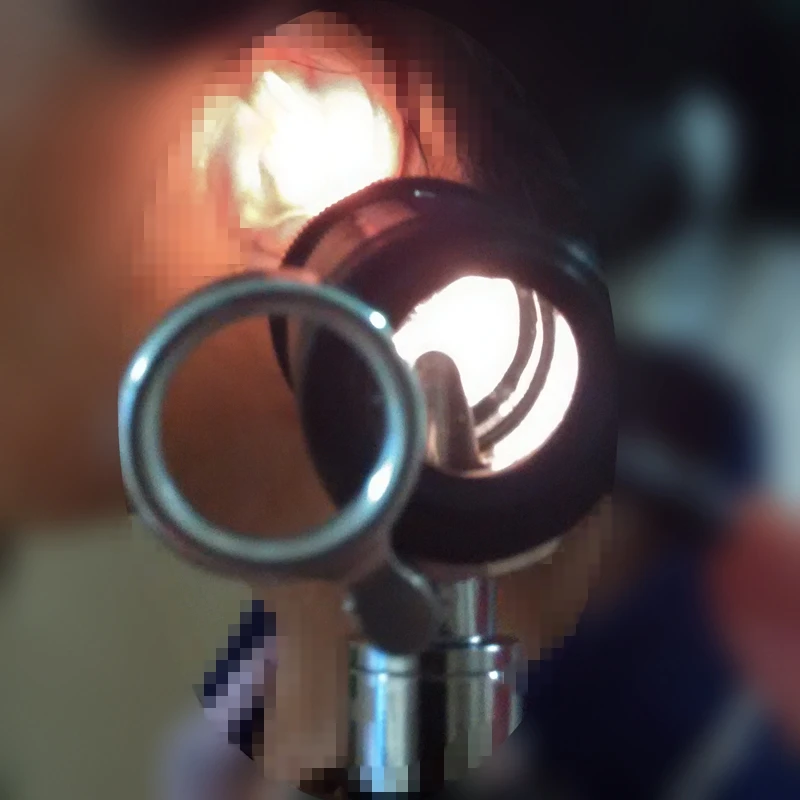 Быстрая Blessfun Профессиональный диагностический отоскопио медицинский ушной отоскоп ушной зеркало с галогенным светильник перепонка проверка