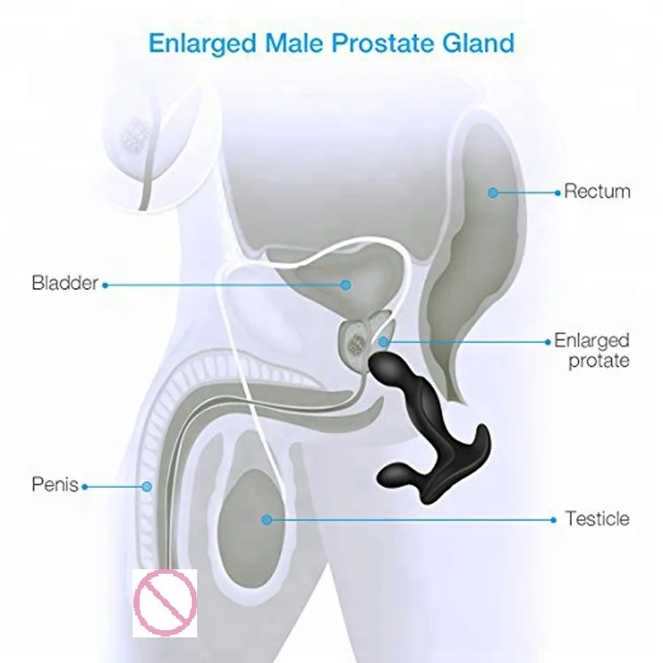 Hot-sale-Remote-control-Prostate-massager-Vibrator