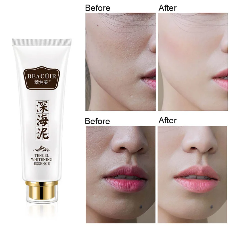 new Whitening Cream Body Underarm Whitening Cream Legs and Knees Private Parts Skin Whitening Korean Skin Care new Whitening Cream Body Underarm Whitening Cream Legs and Knees Private Parts Skin Whitening Korean Skin Care