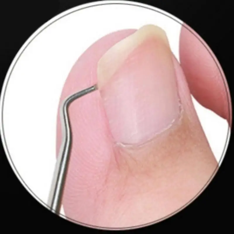 Маникюр плохой ногти для пальцев каблук из нержавеющей стали удаление сломанной коррекция ногтей Paronychia инструмент для очистки-30