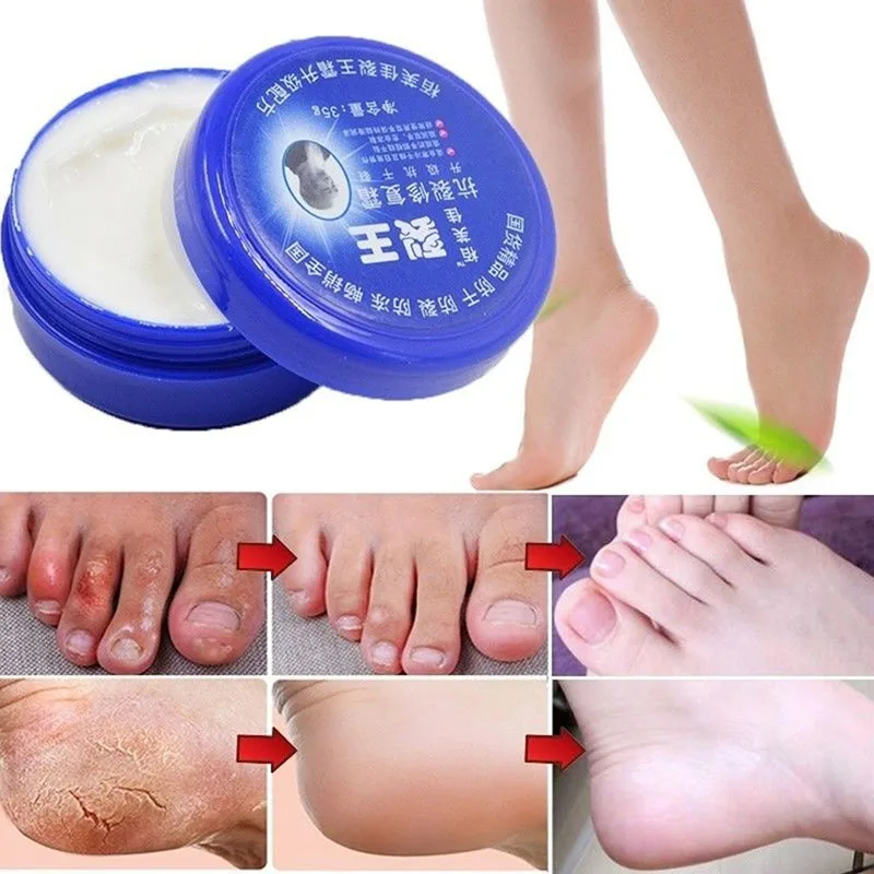 

Skin Care Traditional Chinese Balm Exfoliating Hand Foot Crack Cream Heel Chapped Peeling Feet Hand Repair Anti Dry Crack