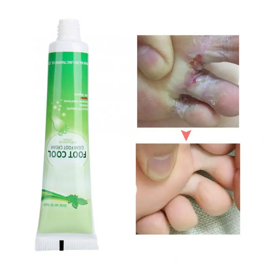 30 г против грибков крем для ног Beriberi уход за кожей ног лечение ...