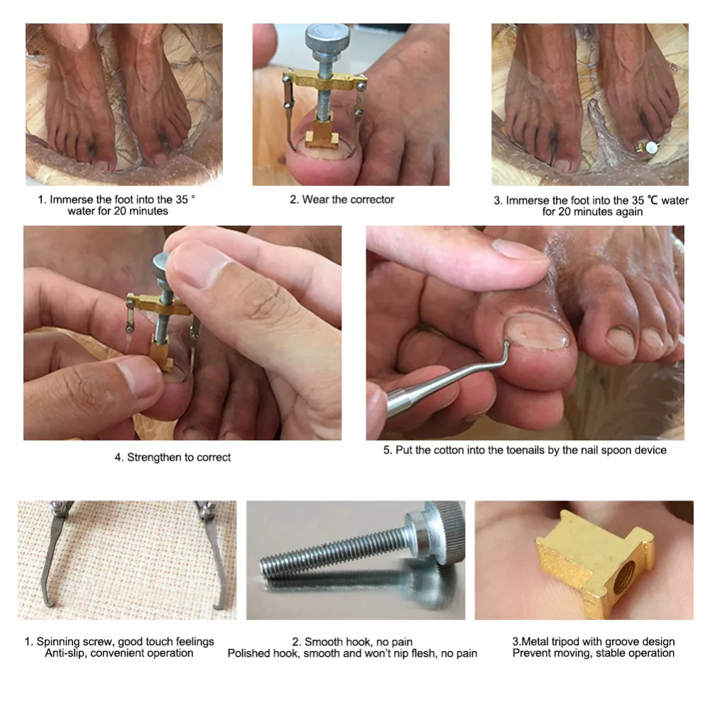 2 шт вросший носок ногтей набор для коррекции ногтей инструмент из нержавеющей стали вросшие ногти маникюр педикюр пилка для ногтей чистый уход инструмент