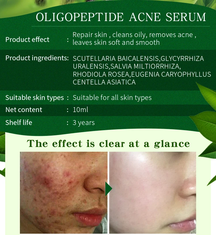 10 mluligopeptide акне очищающий лосьон Сыворотка для лечения акне крем пор восстановление и Отбеливание анти огонек Winkles эссенция увлажняющий