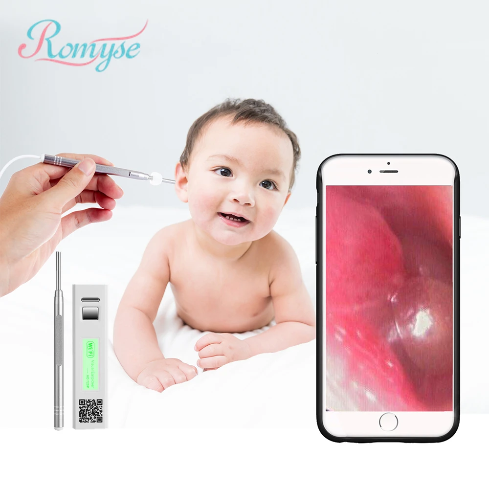 

Wireless Wifi Ear Camera HD Lens Ear Pick Heat Dissipation Ear Otoscope Ear Wax Removal Tool Visual Earpick Cleaner