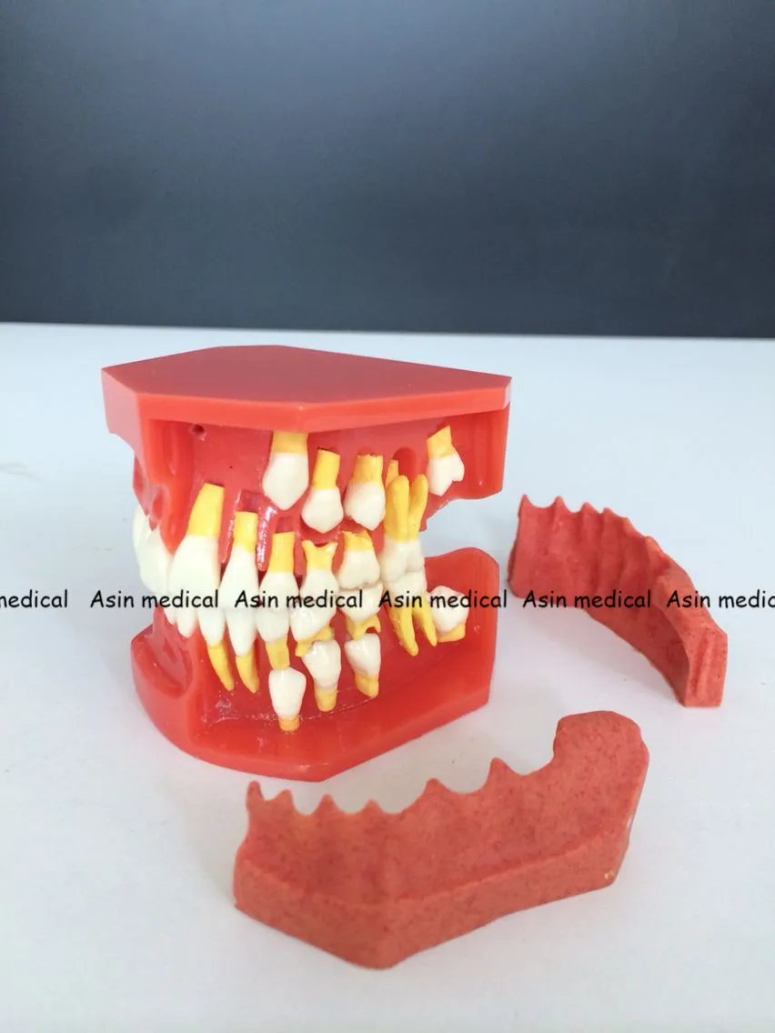 Buy High Quality 2017 New Arrival Dental Tooth Teeth Anatomical Anatomy Model