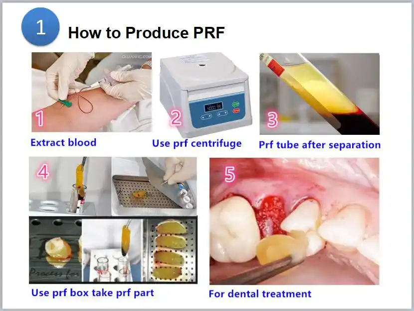 Центрифуга PRP PRF с угловым ротором, 8 трубок, 15 мл, подходит для различных трубок prp и PRP kit