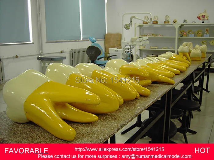 DENTAL CARIES MODEL DENTAL DENTAL MODEL DENTAL CAST MODEL FOR DEPARTMENT 15 TIMES THE BIG FRONT