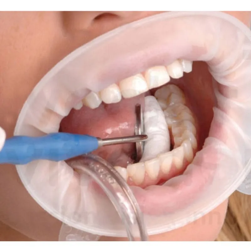10 шт. Стоматологические Одноразовые резиновые стерильные рот открывалка оральные расширители щеки Ретрактор резиновая дамба рот открывалка