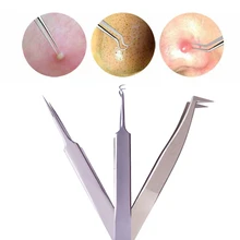 1Pc Blackhead Acne Extractor Tweezer Sharp Pointed Stainless Steel Curved Nipper Comedone Remover Makeup Face Care Tool