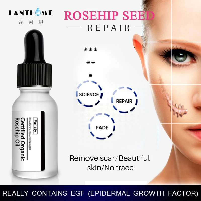 best product to lighten stretch marks