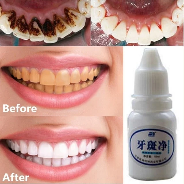 1 Bottle 10 Ml Teeth Whitening Mouth Cleaning Liquid Whitening Dental