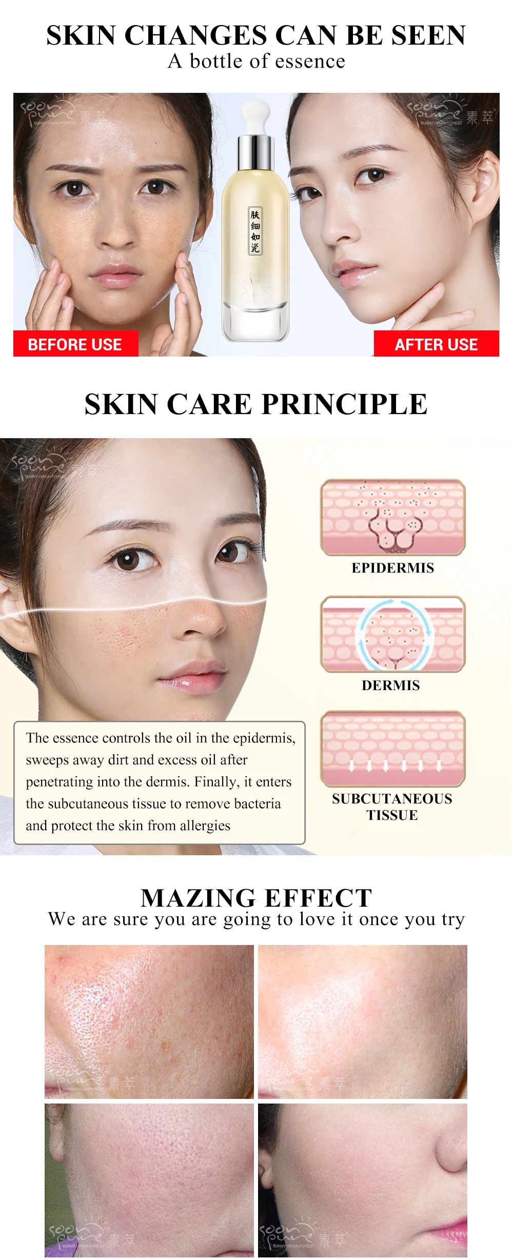 Shrink Pores Blackhead Remover Acne Spots Face Essence_03