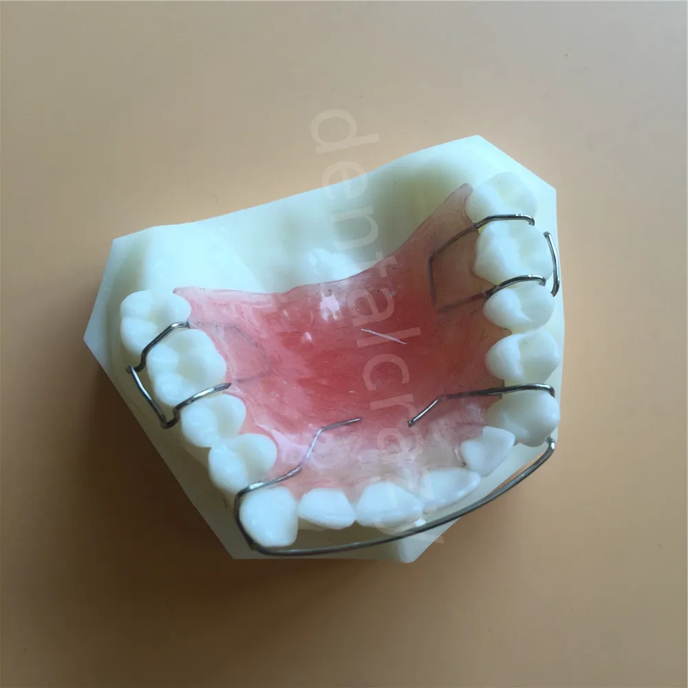 Стоматологическая модель для исследования зубов, модель фиксатора Hawley, модель стоматологического материала 3007 01 модель зубов