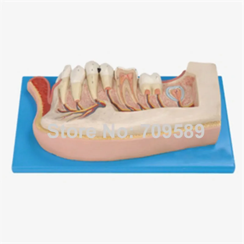 

Lower Jaw of 12-year-old, Children Dentition Model, Teeth Model