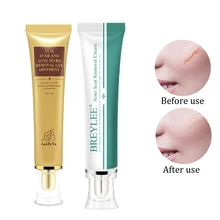 Удаление Шрама от акне крем отбеливание чёрных точек Крем Растяжек женьшень эссенция анти акне средство для удаления акне уход за лицом Макияж Уход за кожей