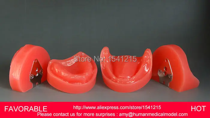 

ORAL TEETH MODEL,MANDIBULAR IMPLANT DENTAL DENTAL MODEL ,NATOMIACL TOOTH MODELS,MOUTH ORAL CARE MODEL-GASEN-DEN014