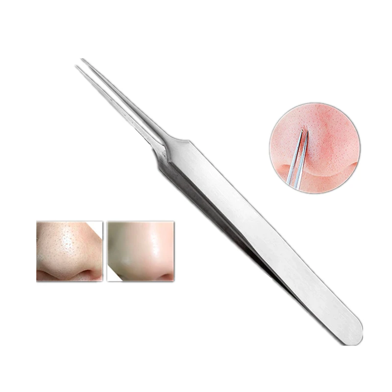 3pcs-set-The-High-Quality-Blackhead-Tweezers-Blackhead-Blemish-Removers-Blemish-Acne-Pimple-Extractor-Face-Skin (1)