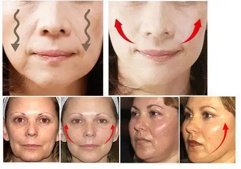 Уход за здоровьем похудение тонкая маска для лица компактный тонкий массаж Многофункциональный мощный тонкий пояс для лица