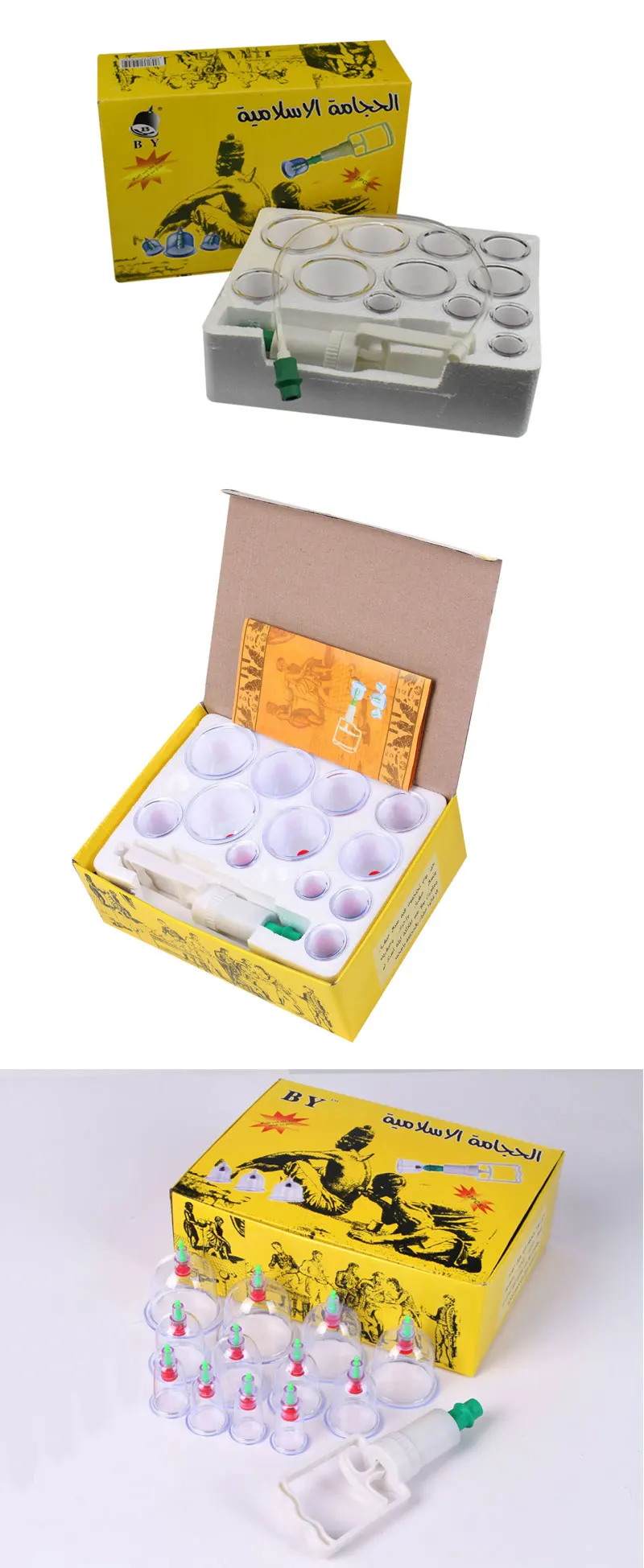 cupping (4)