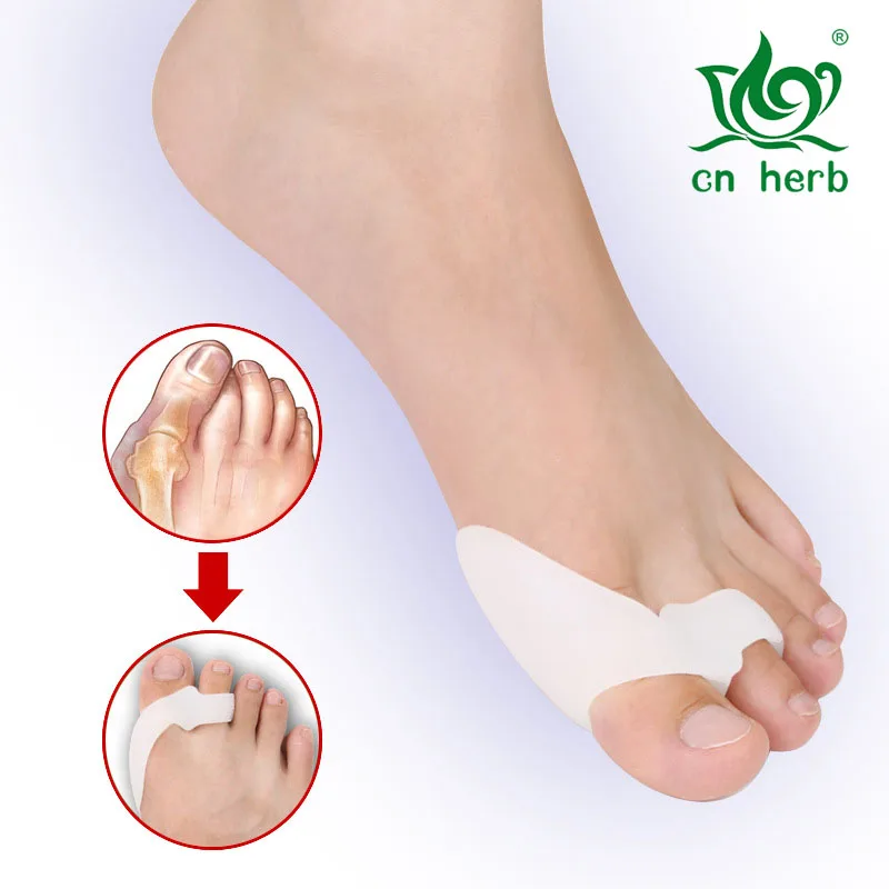 

The big toe hallux valgus orthosis brace toe separator SEBS appliance