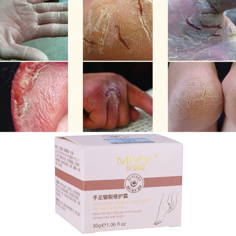 

lot Hand Foot Crack Cream Heel Cracked Peeling Anti Dry Crack Repair Skin Care Hand and Foot Cream