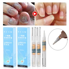1 шт. Новое Лечение ногтей от грибка жидкая ручка яркий ногтей палец и носок ремонт Onychomycosis эссенция для удаления ног Инструменты для здоровья