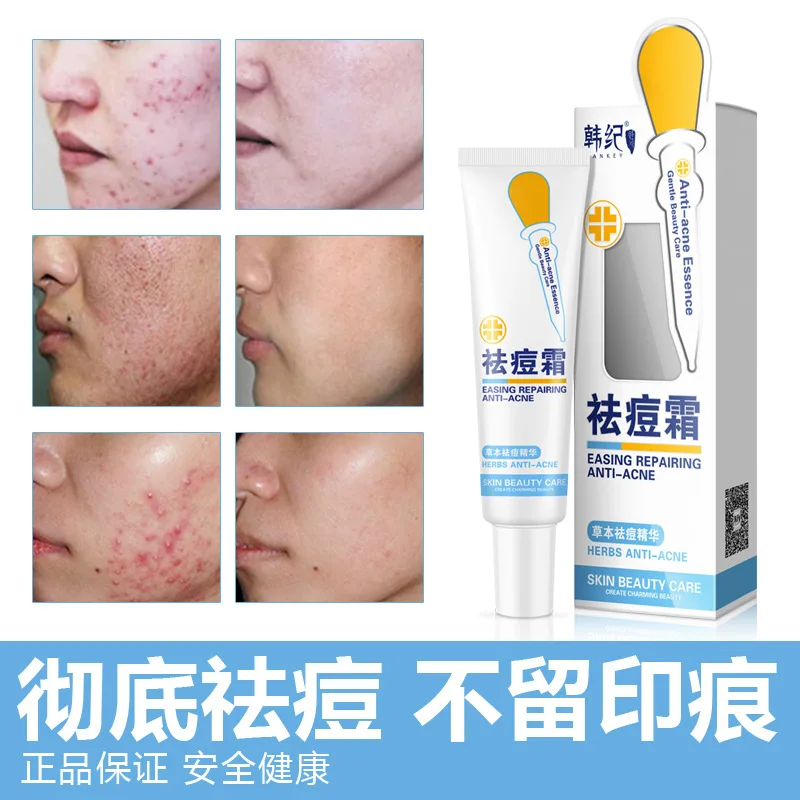 Buy HANKEY Face Care Acne Scar Removal Cream Acne