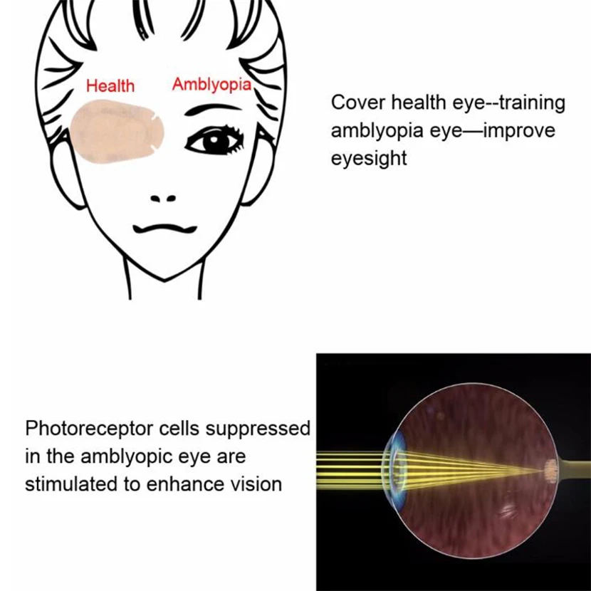 20 шт. мягкая детская Amblyopia Training Eyeshade Amblyopia Orthoptic исправленные патчи для глаз детская окклюзия медицинская ленивая маска для глаз