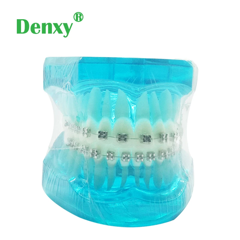 Denxy 1 шт. Ортодонтическая модель для пациента обучающая зубная Чистка инструкция модель с зубной скобкой стоматолога обучающий стоматологический инструмент