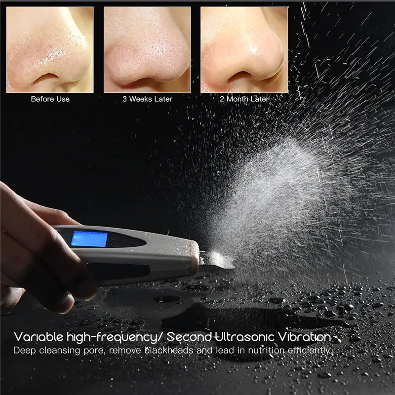 Facial Ultrasonic Skin Scrubber Spatula Infusion Exfoliation Ultrasound Face Cleaning Peeling Pore Cleaner Blackhead Remover 39