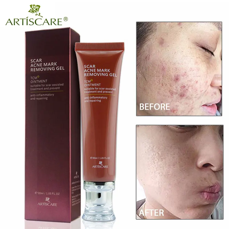 ARTISCARE Scar Acne Mark Removing Gel TCM Blackhead Treatment Repair