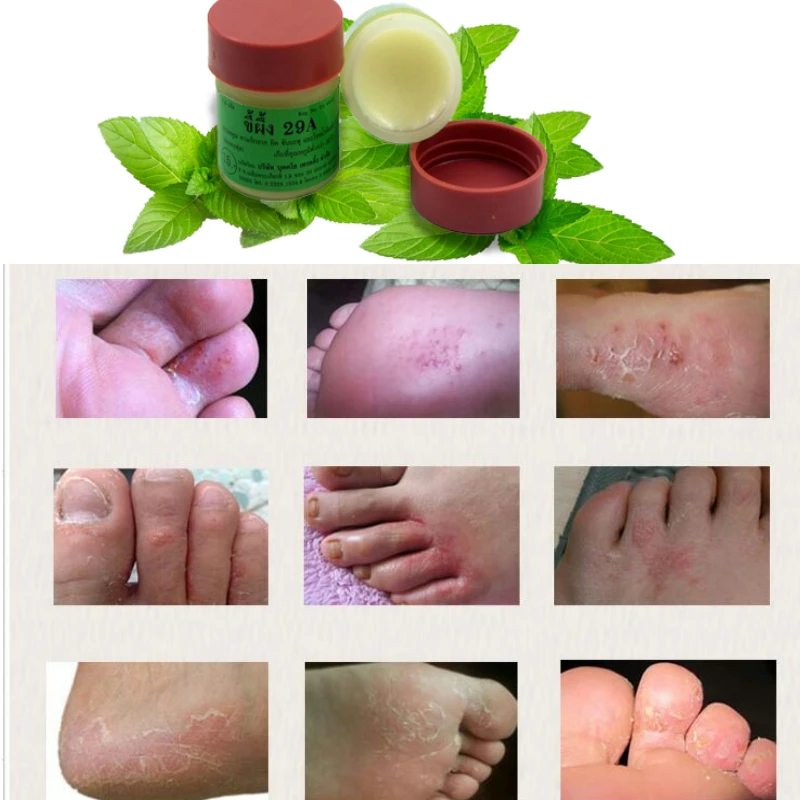 4 шт. 29а псориаз все виды кожи проблемы патч тела мазь для массажа китайская медицина имеет здоровую кожу улучшить сексуальную жизнь