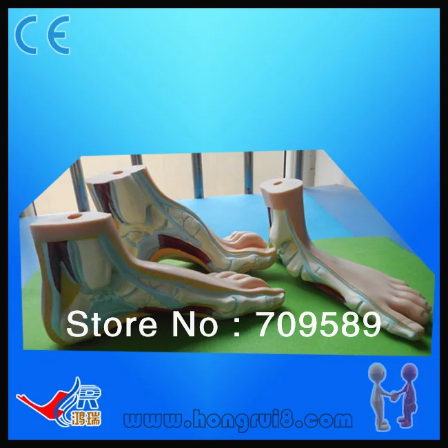 

Normal, Flat and Arched Foot, Foot Anatomy Model