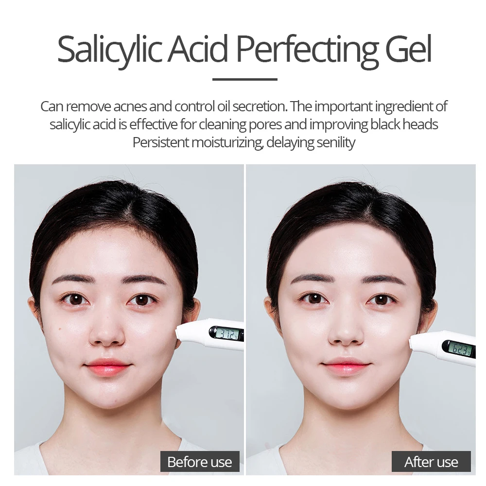 salicylic acid for skin