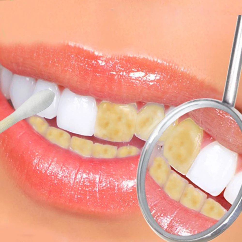 

25g Thailand Original Herbal Clove Toothpaste Anti-bacteria Whitening Remove Smoke Tea Yellow Stains Plaque to Halitosis