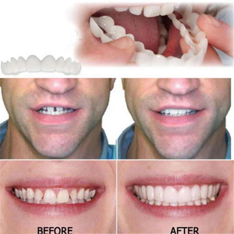 Beautiful Comfort Fit Flex Cosmetic Teeth Denture Teeth Top Cosmetic Veneer