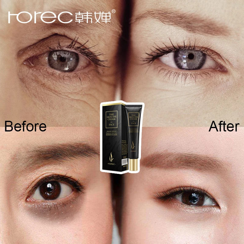 

ROREC Eye Cream Hyaluronic Acid Anti-Wrinkle Eye Serum Remover Dark Circles Essence anti-Puffiness Aging Moisturizing Care