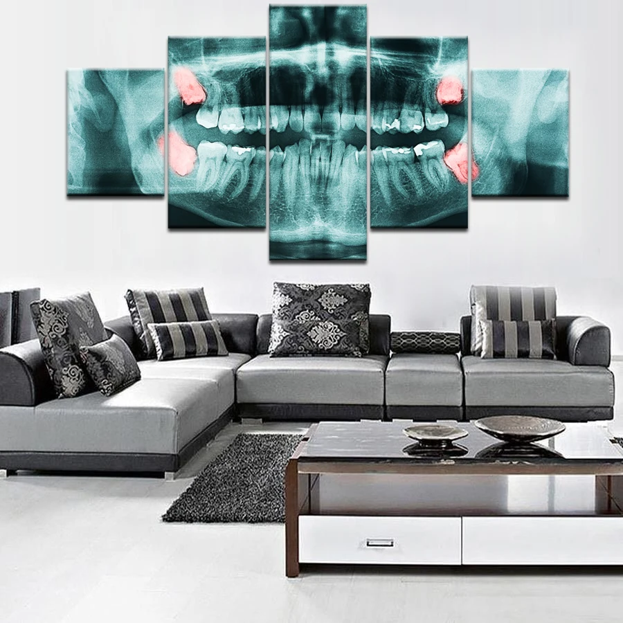 5 шт. холст x-ray of Wisdom Teeth стоматологический Холст Картина декор комнаты печать плакат стены Искусство WD-3056