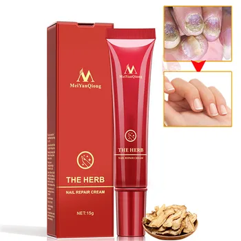 

Nails Treatments Cream Powerful Nail Foot Protector Skin Care Cream Nail Fungus Treatment Herb Nails Repair Cream SK88