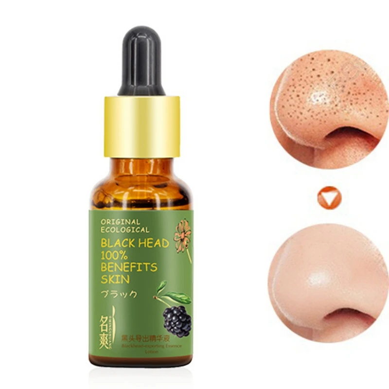 Blackhead Eradicator Serum Blackhead Removal Essence Clears Skin