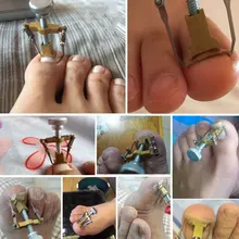 Ingrowntoe/коррекция ногтей инструмент фиксаж восстановить/пышные nailcurlertoe паронихии/Лак для ногтей бандаж инструменты для вросших ногтей, педикюра инструмент