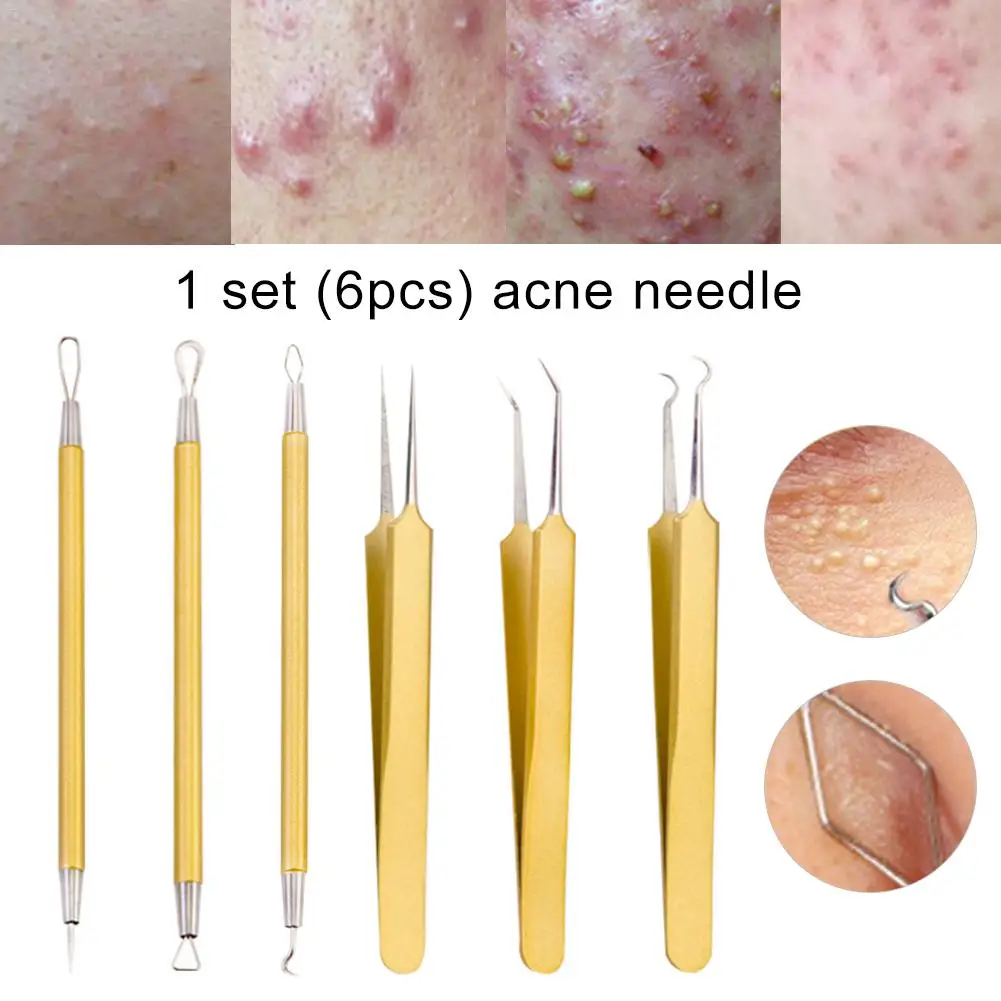 

6PCS/Set Stainless Steel Blackhead Remover Or Comedone Extractor Curved Tweezers Kit Pimple Acne Pin Blemish Removal Tools