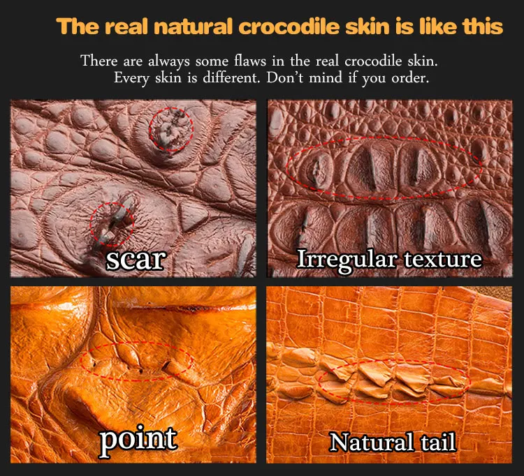 Case de Couro de Crocodilo para Xiao Capas para Xiao Escudo de Luxo para mi Original Voltar Explorar Lite a2 Nota Vermelha 7 mi 9 se 8 9 Original caso de couro de crocodilo para