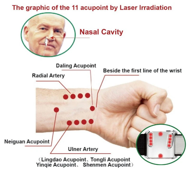 2016 hot diabetic device soft cold laser acupuncture therapy wrist watch 2016 hot diabetic device soft cold laser acupuncture therapy wrist watch